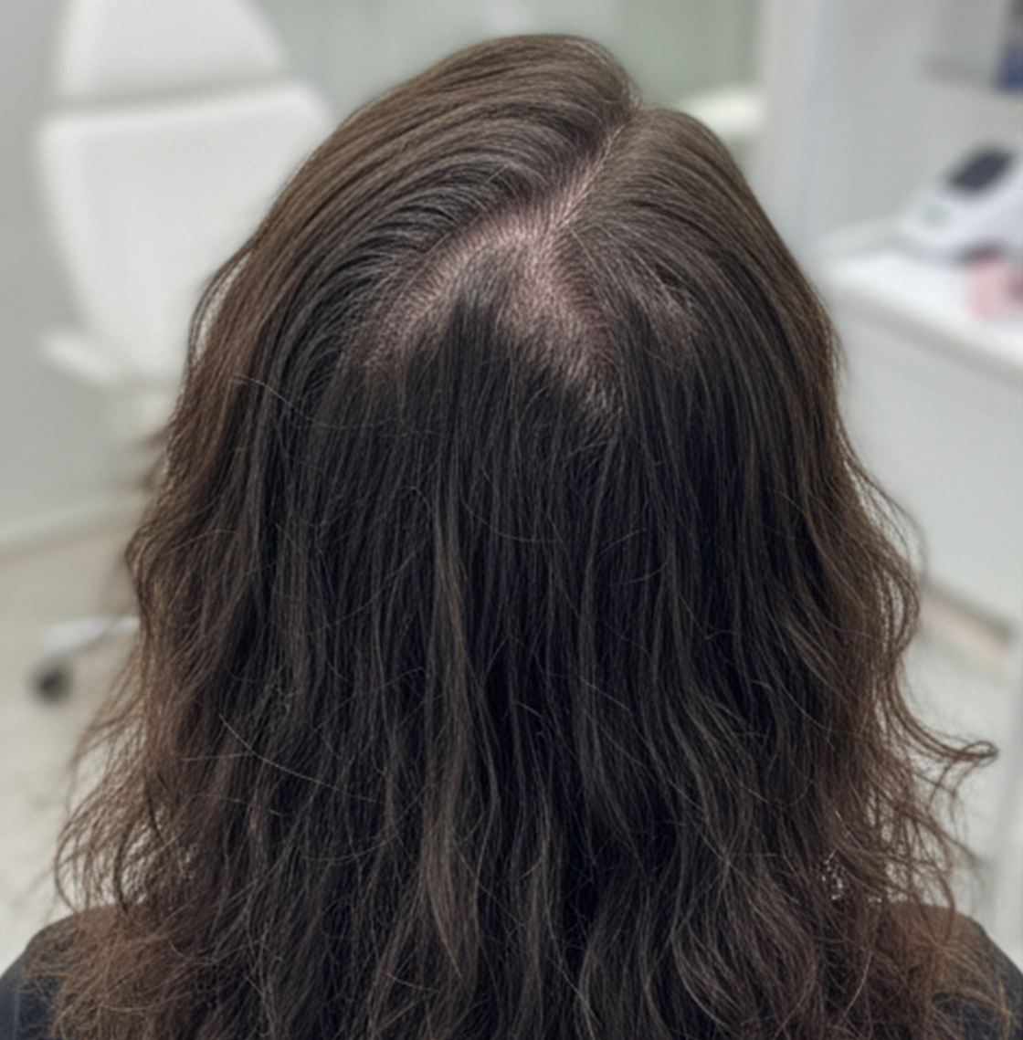 Before - Cheveux service